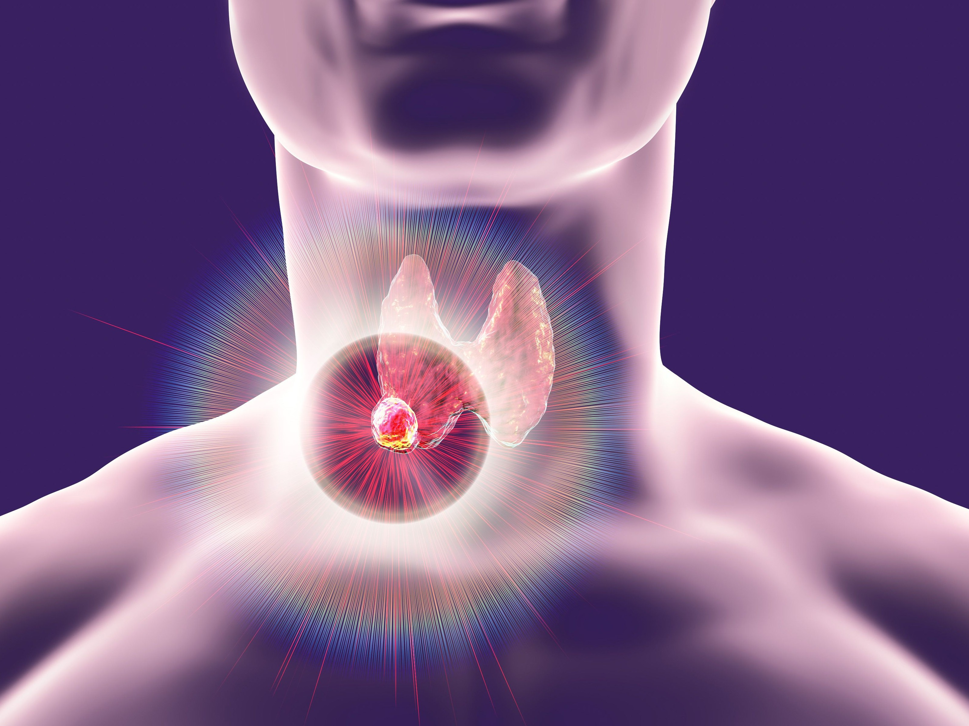 Thyroid Cancer: What you need to know - Penang Adventist Hospital 